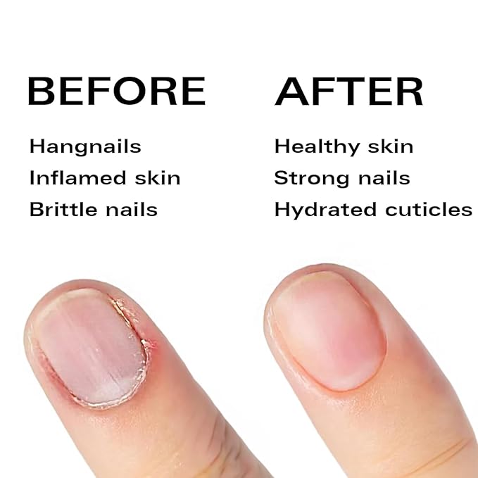 Nail Oil Cuticle Pen - Watermelon - Nail Strengthener & Growth Serum with Vitamin A, D, E, B5, Grapeseed & Natural Oils - Repair for Brittle, Peeling, Thin Nails - Twist Brush Pen