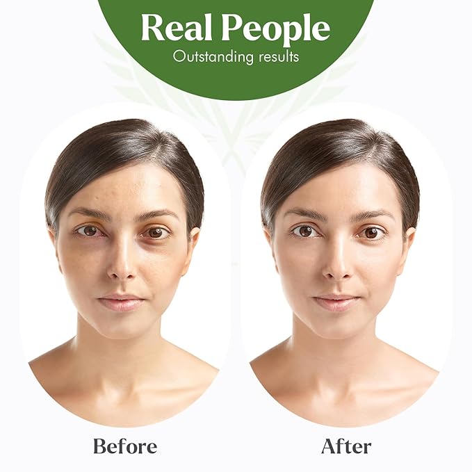 USDA Certified Organic Neem Oil (4 Oz) 100% Pure Natural Oil, Hair Growth, Skin, & Body Care, Nails, Acne, Anti-Aging Moisturizer