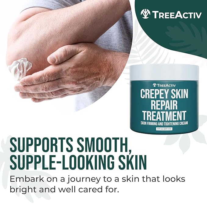 TreeActiv Crepey Skin Repair Cream, 8 oz, Firming Formula with Hyaluronic Acid & Shea Butter to Deeply Moisturize and Tighten Dry, Wrinkly Crepe Skin, 500+ Uses