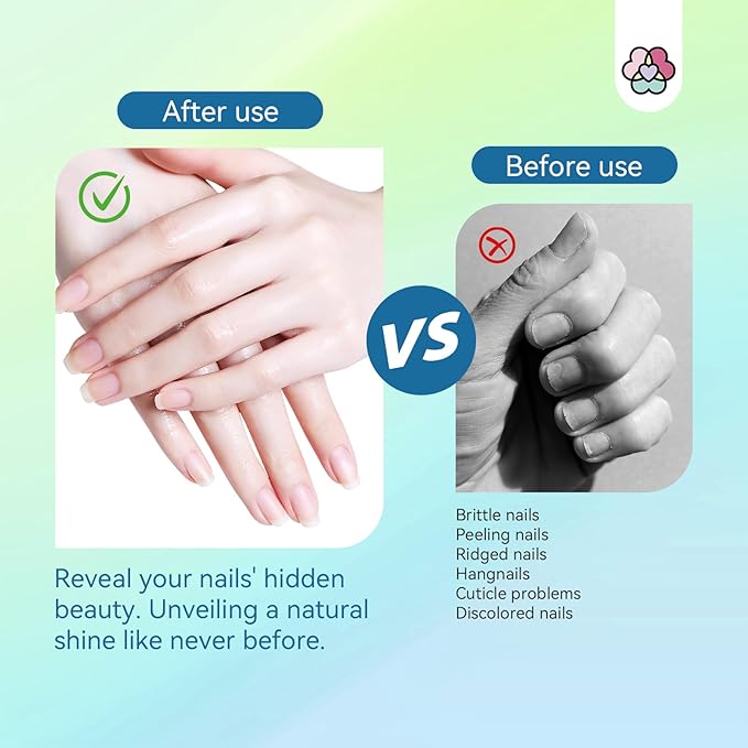 SAVILAND Cuticle Oil Triple Essential: 50ml Vitamin E & C Jasmine Gentian Grapeseed Nail Growth Oil Ultra Repair Nourish Soothe Cuticle Oil For Nails Plant-based Strengthener For Weak Nail