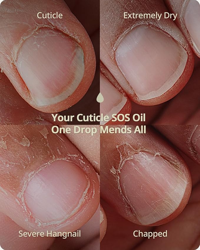 BTARTBOXNAILS Nutri-Forte Cuticle Oil - Pure Oil Formula with Olive Oil, Vitamin E, Squalane, Deep Repairing & Nourishing & Strengthening Treatment for Severe Nail Concerns, 15ml