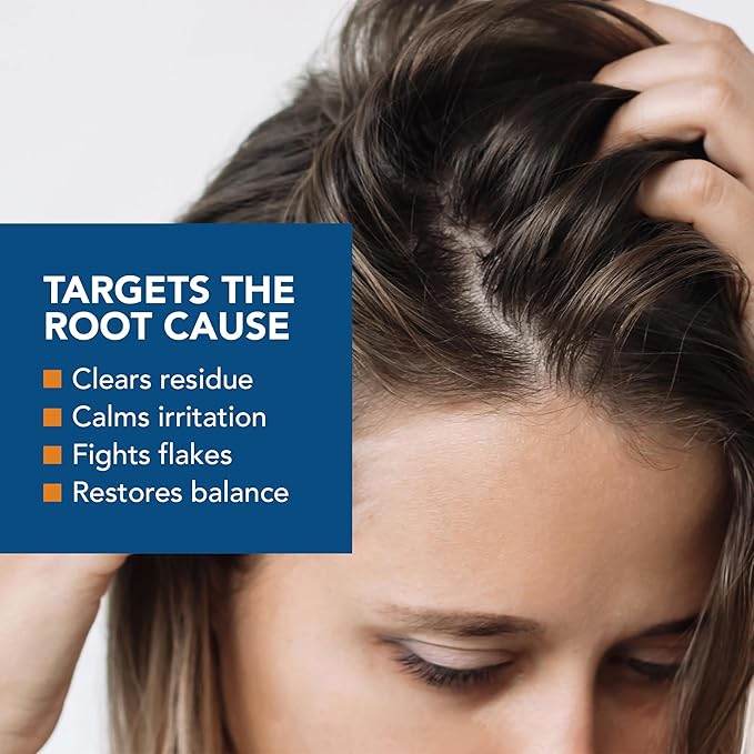 Kenkoderm Psoriasis Conditioner for Sensitive Hair & Skin with 3 Percent Salicylic Acid, Anti-Dandruff Deep Moisturizer for Itchy or Dry Scalp Relief, Color & Fragrance Free, 8-Ounce Tube